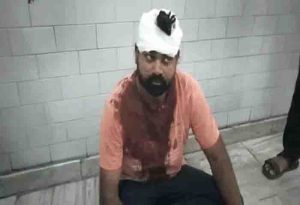 The villagers beat up the power workers as thievs