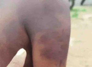 tribal youth beaten in forest guard on suspicion of theft