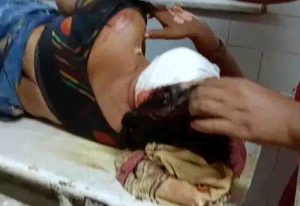 Thieves escaped by attacking the women with an ax