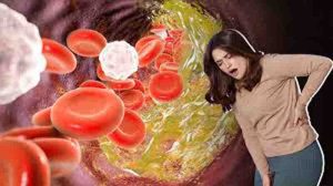 Pain occurs in these parts when cholesterol increases