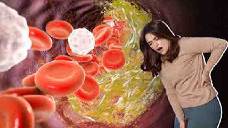 Pain occurs in these parts when cholesterol increases